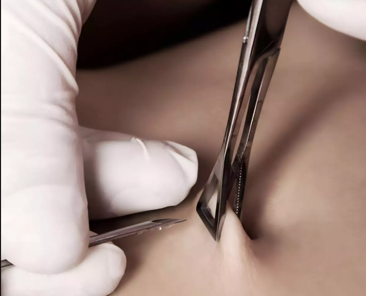 Piercing professionnel, Beauport